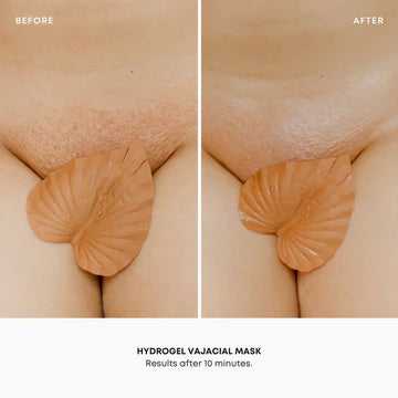 Hydrogel Vajacial Side Strips