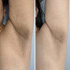 Dark Spot Exfoliating Scrub